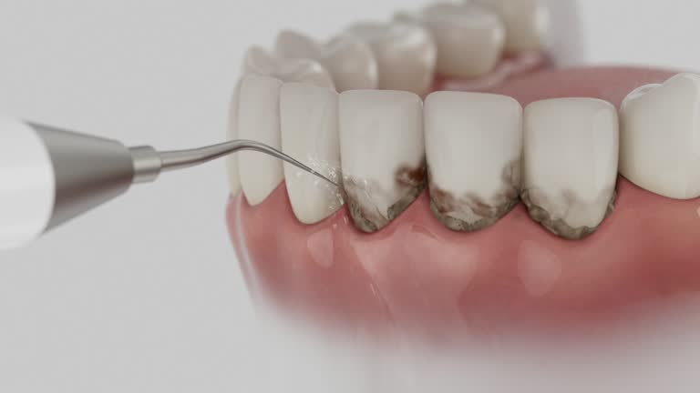 Reliable Dental Implants contractor in Riverview, DE by Smile Center Dentistry
